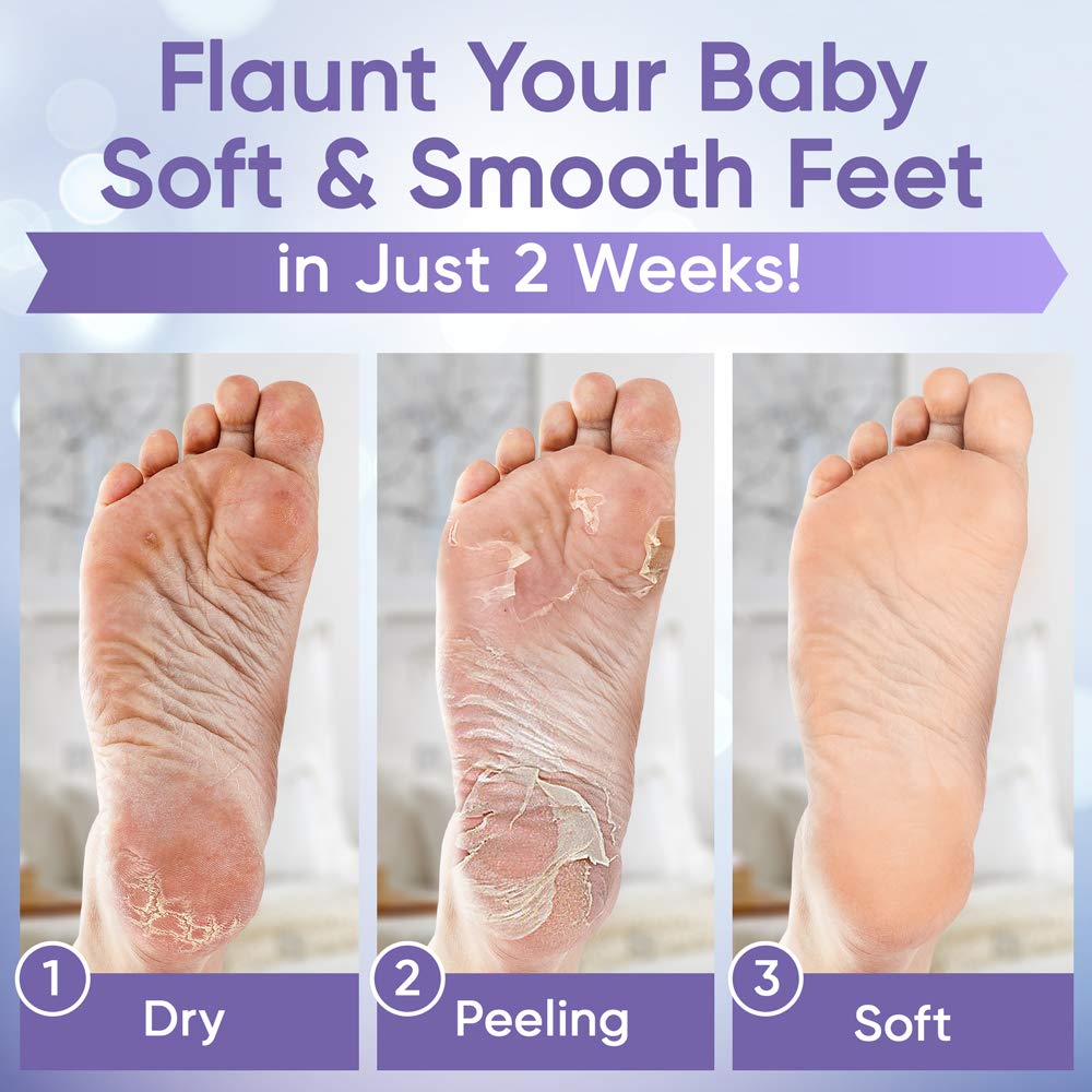 Foot Peel Mask